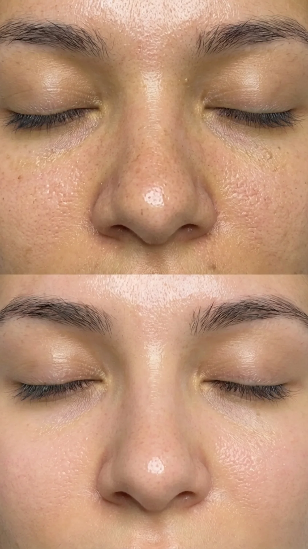 Two client photographs supplied together by Mehak for Hydrofacial